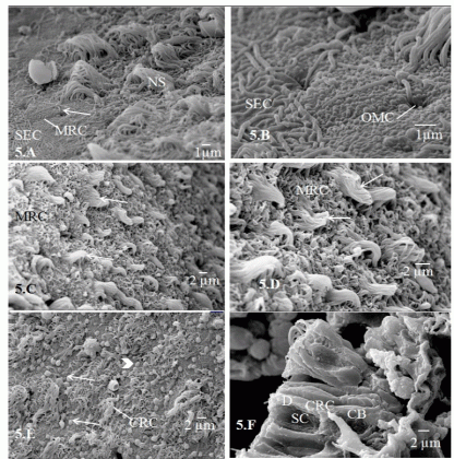 histological organization and ultr structures of the apical surf medium