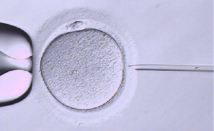 intracytoplasmic sperm injection icsi fertility medium