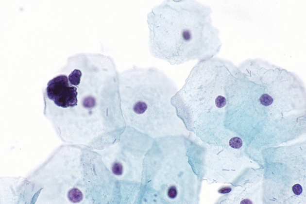 file endometrial cells on pap 2 very high mag gif wikimedia medium