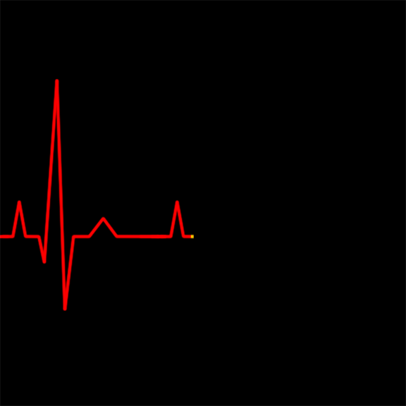 bioresonance eeg heartbeat conversation starters facts about love medium