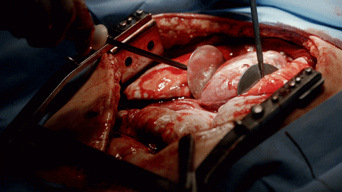 heart transplant gifs find share on giphy medium