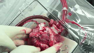 cool science gifs manually pumping a heart small