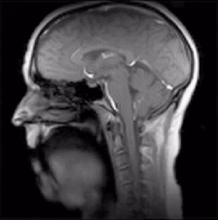 dynamic mri gif find share on giphy small